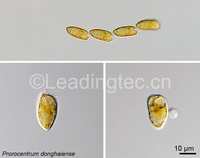 Prorocentrum donghaiense