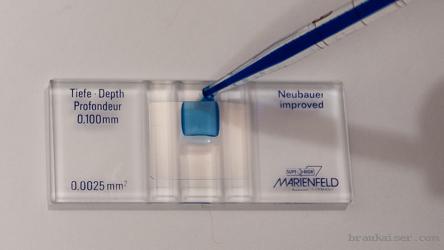 血球計(jì)數(shù)板的加樣示意圖