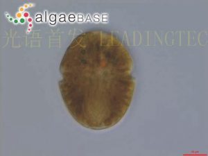 圖18.裸甲藻（Gymnodinium uberrimum） (AlgaeBase Image Reference: 22537）